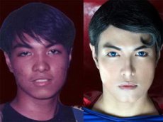 Хирурги сделали Супермена из филиппинца