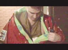 Солист группы "Иванушки" сломал руку