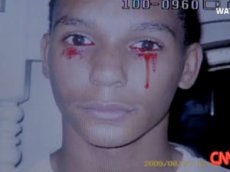 Американский мальчик плачет кровавыми слезами