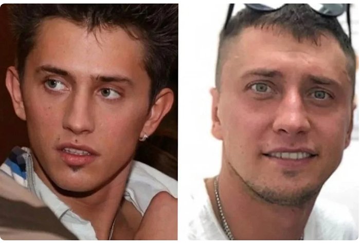 Павел Прилучный до пластики ушей