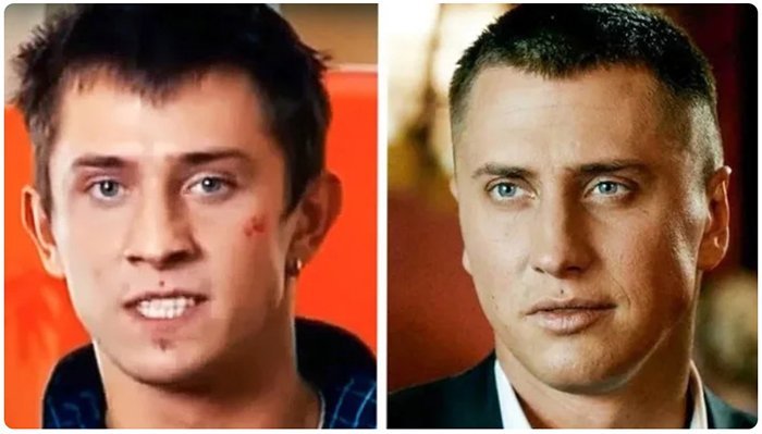 Павел Прилучный сделал пластику ушей