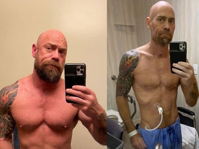 Медбрат переболел коронавирусом