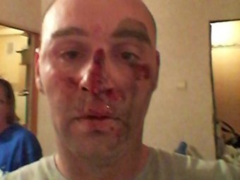Активиста "Синих ведерок" избили прямо на глазах сотрудника ДПС