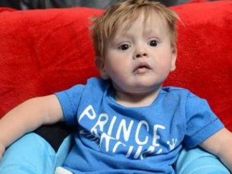 Двухлетний мальчик с мутацией шокировал врачей неизвестной болезнью