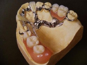 Под Санкт-Петербургом археологи нашли зубной протез работы Фаберже