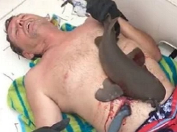 На YouTube появилось видео, как усатая акула-нянька вцепилась в живот ныряльщику мёртвой хваткой