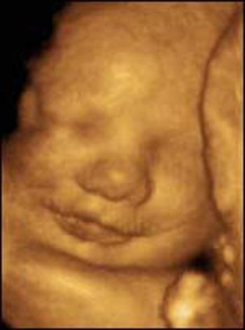 Человеческий эмбрион умеет плакать, зевать и чувствовать смерть. ШОКИРУЮЩИЕ КАДРЫ