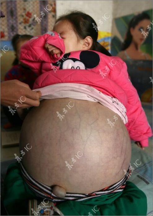 Беременная Китаянка С Большим Животом В Купальнике