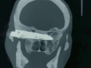 Интернет-пользователи высмеяли блогершу 