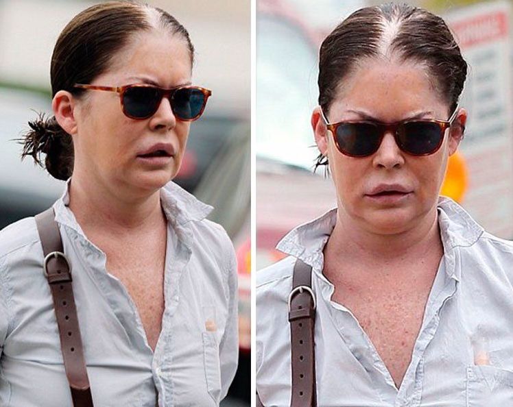 8 звезд кино, которые потеряли карьеру после пластических операций