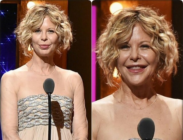 8 звезд кино, которые потеряли карьеру после пластических операций