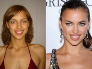 Ирина Шейк до и после пластики