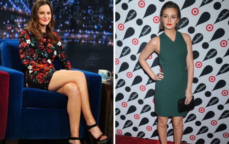 Знаменитости, которые недостатки внешности превратили в достоинства