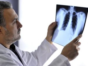 Ученые нашли особенность в легких пациентов, умерших от коронавируса