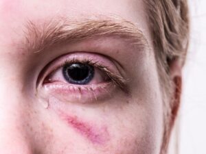 Назван первичный симптом коронавируса