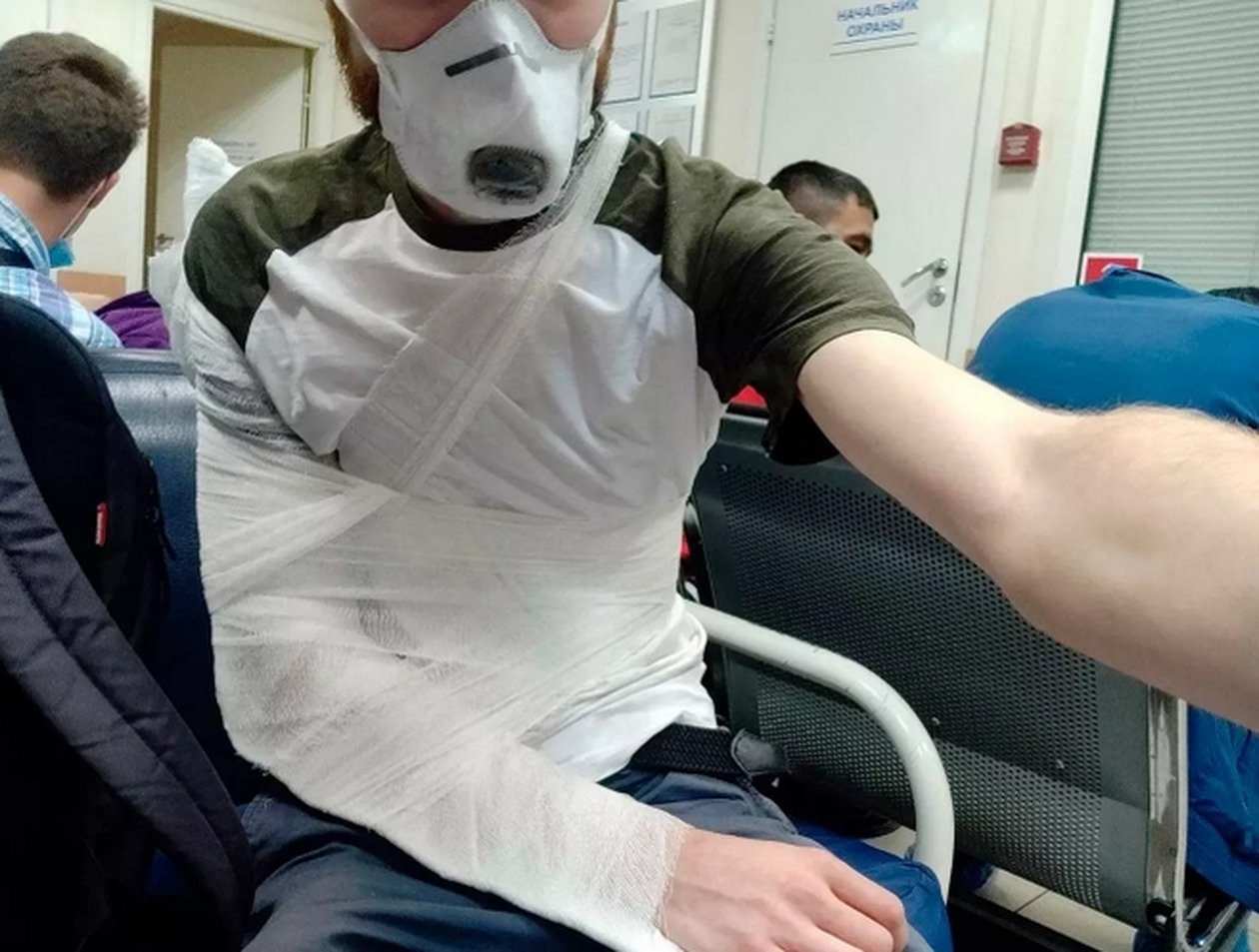 Журналисту сломали руку на избирательном участке в Петербурге