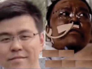 В Ухане врач почернел из-за лекарства от коронавируса и умер