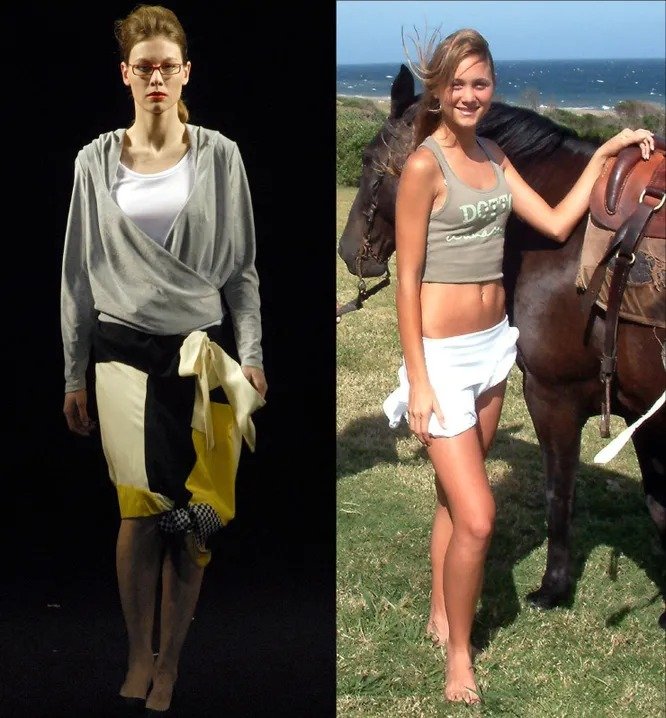 10 знаменитых девушек, которым худоба стоила жизни