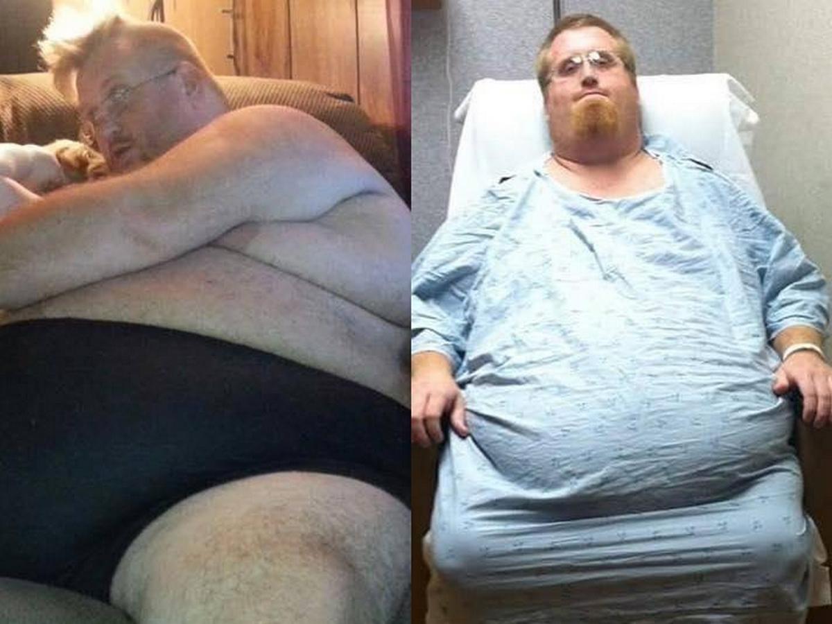 Американец похудел на 150 килограммов