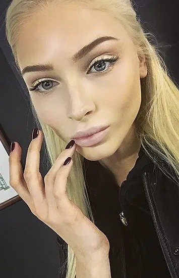 Красота в прошлом: модели, которые испортили свою внешность пластикой