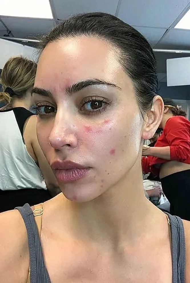 Физиологические особенности, которые скрывают звезды