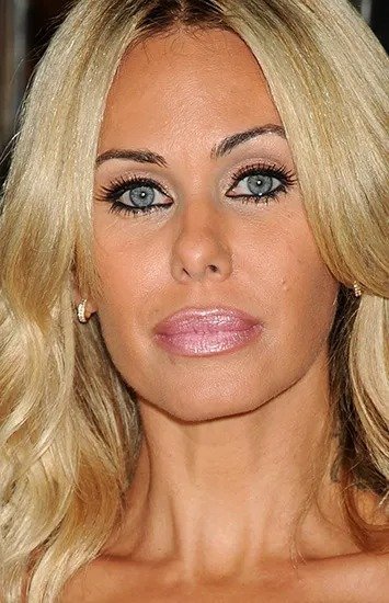 Красота в прошлом: модели, которые испортили свою внешность пластикой