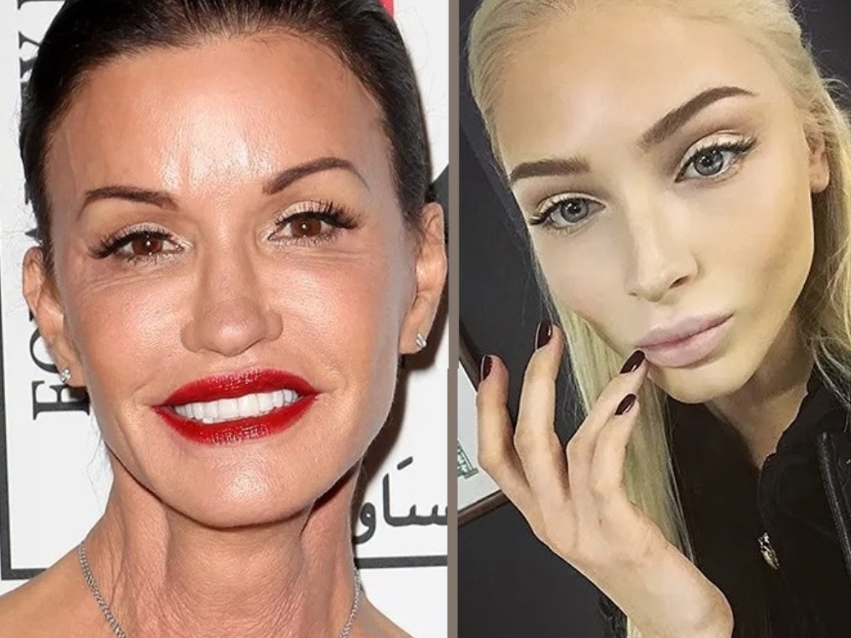 Красота в прошлом: модели, которые испортили свою внешность пластикой