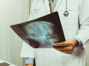 Новый орган человека