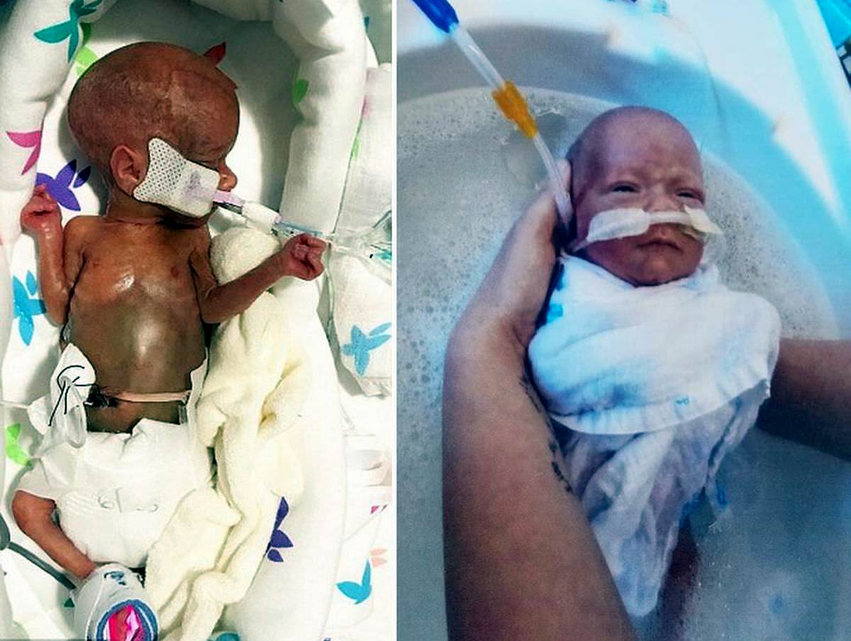 ребенок 340 граммов