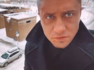 Шрамы на лице Павла Прилучного