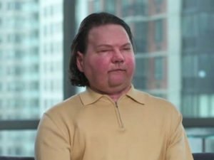 Видео о Джо Димео, которому пересадили лицо и руки, собрало 96 тыс. просмотров