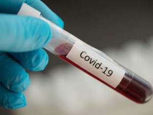 Ученые рассказали, когда заболевшие COVID-19 наиболее заразны