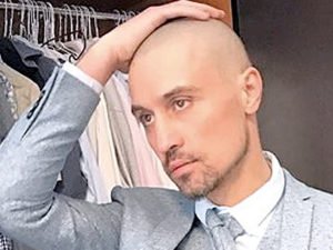 Дима Билан поделился с подписчиками результатами экспериментов с волосами