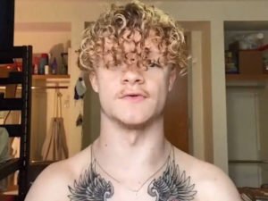 Парень с редким заболеванием благодаря TikTok перестал стесняться и нашел друзей