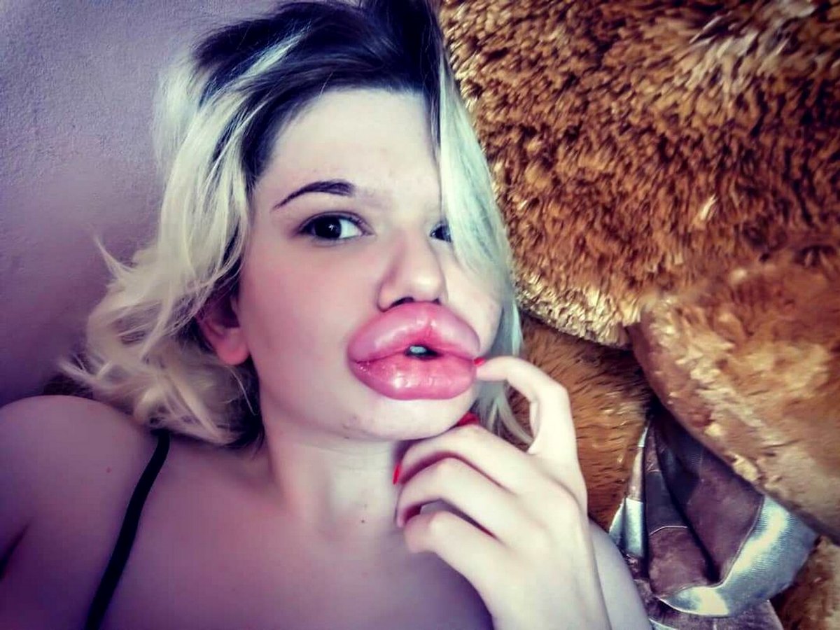 Девушка из Болгарии накачала себе самые большие губы в мире