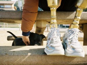 Модель лишилась ног из-за средств гигиены