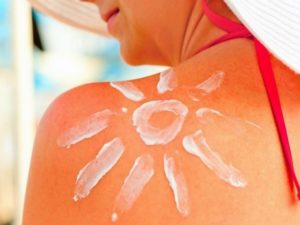 Блогерша прославилась, раскрыв альтернативный способ лечения ожога