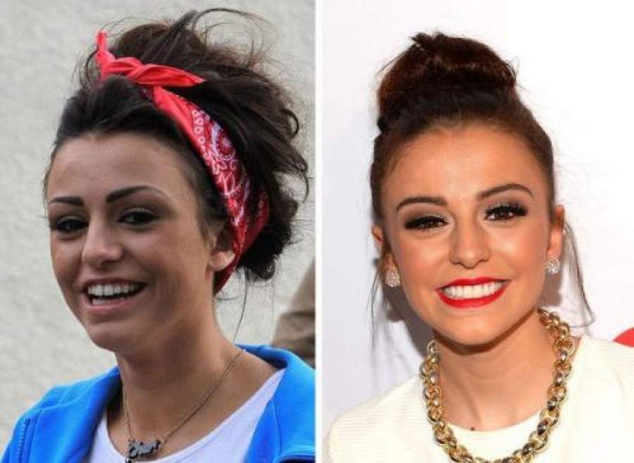 Звезды, внешность которых изменила коррекция зубов