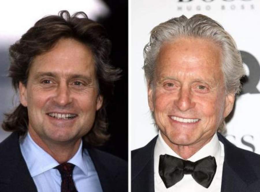 Звезды, внешность которых изменила коррекция зубов