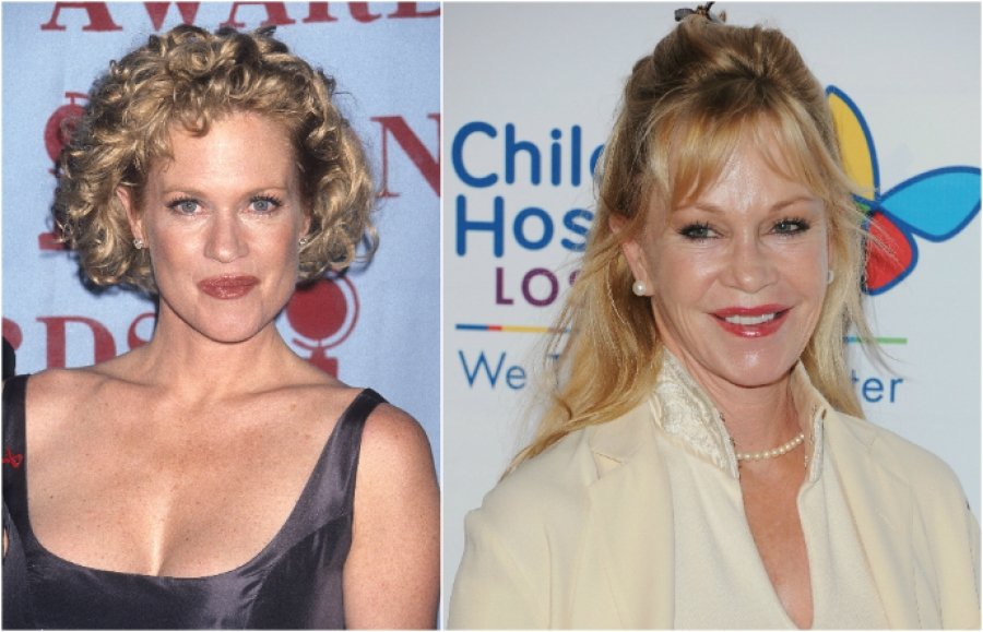 Как выглядели голливудские звезды до пластики