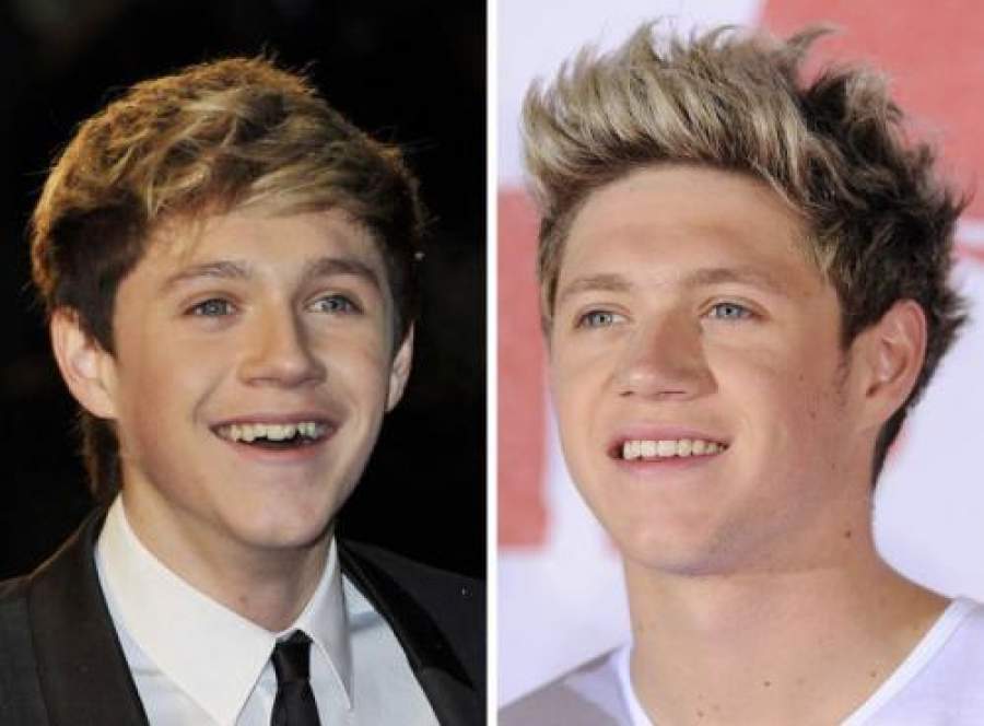 Звезды, внешность которых изменила коррекция зубов