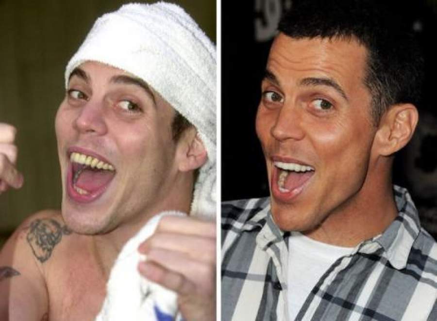 Звезды, внешность которых изменила коррекция зубов