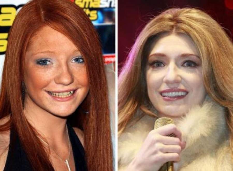 Звезды, внешность которых изменила коррекция зубов