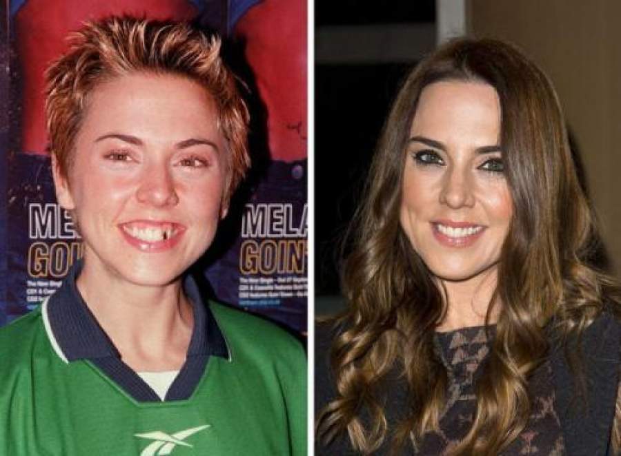 Звезды, внешность которых изменила коррекция зубов