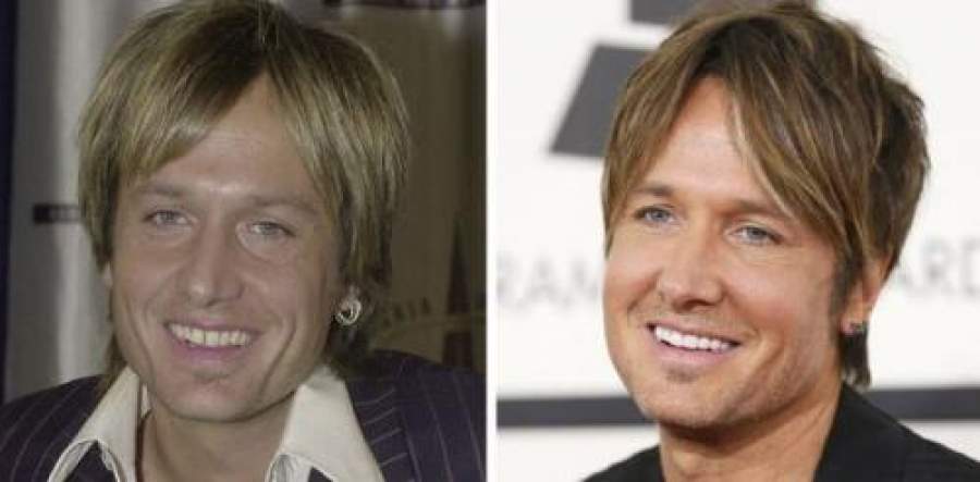 Звезды, внешность которых изменила коррекция зубов