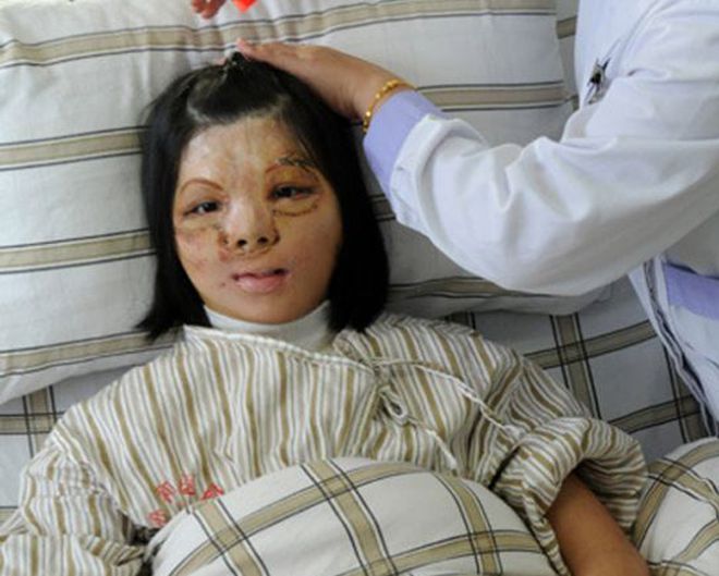 Самые первые и невероятные пересадки человеческих органов