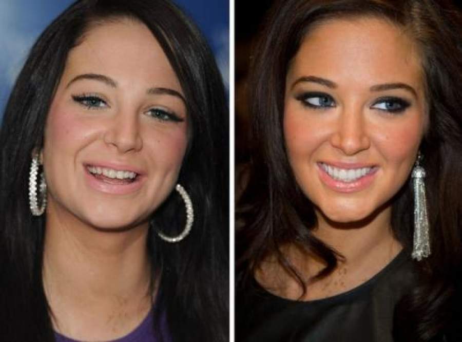 Звезды, внешность которых изменила коррекция зубов