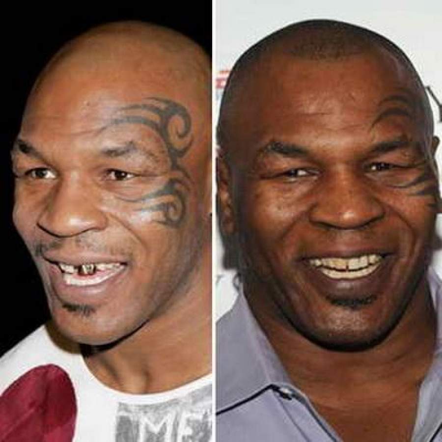 Звезды, внешность которых изменила коррекция зубов