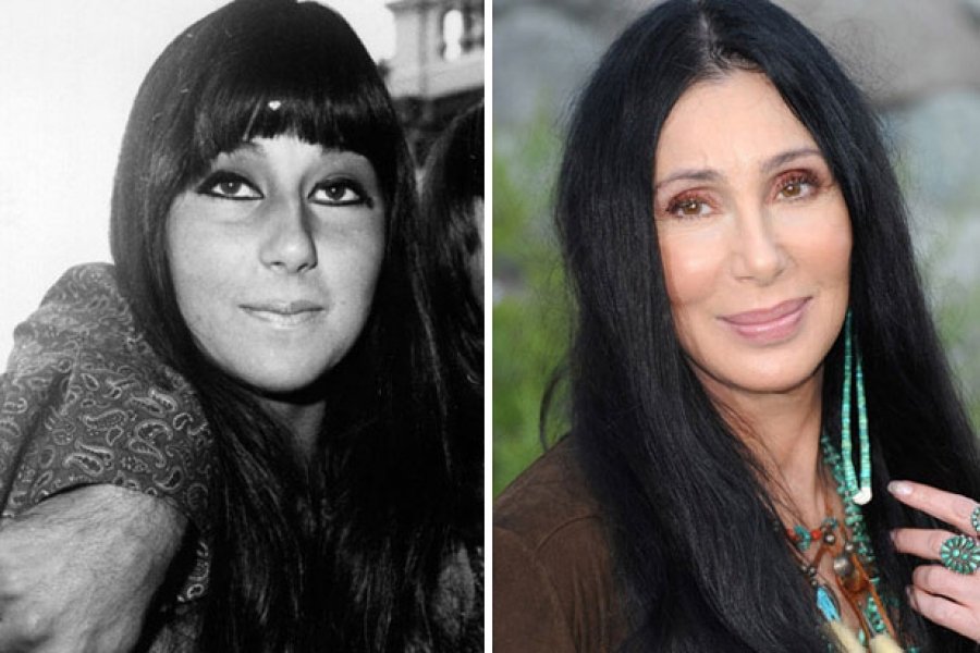 Как выглядели голливудские звезды до пластики