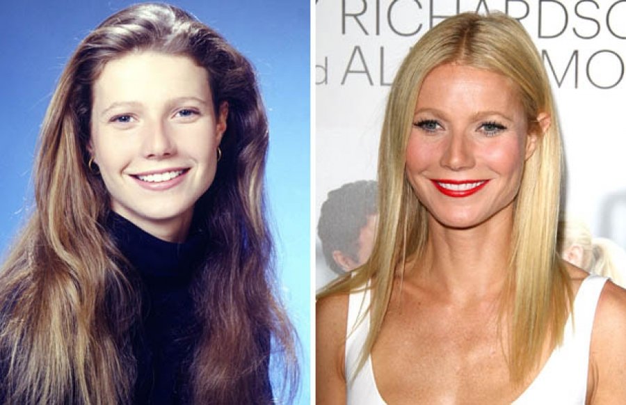 Как выглядели голливудские звезды до пластики